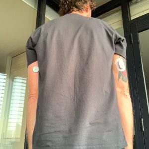 dexcom vs freestyle libre 