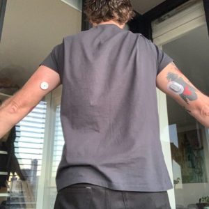 dexcom vs freestyle libre 