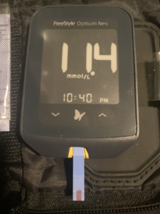 dexcom g6 vs freestyle libre 