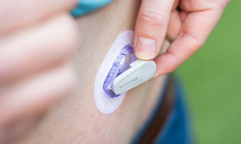 Dexcom_vs_Medtronic_G6_transmitter