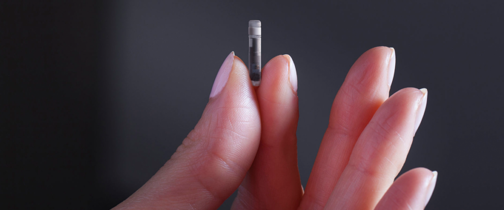 eversense cgm sensor
