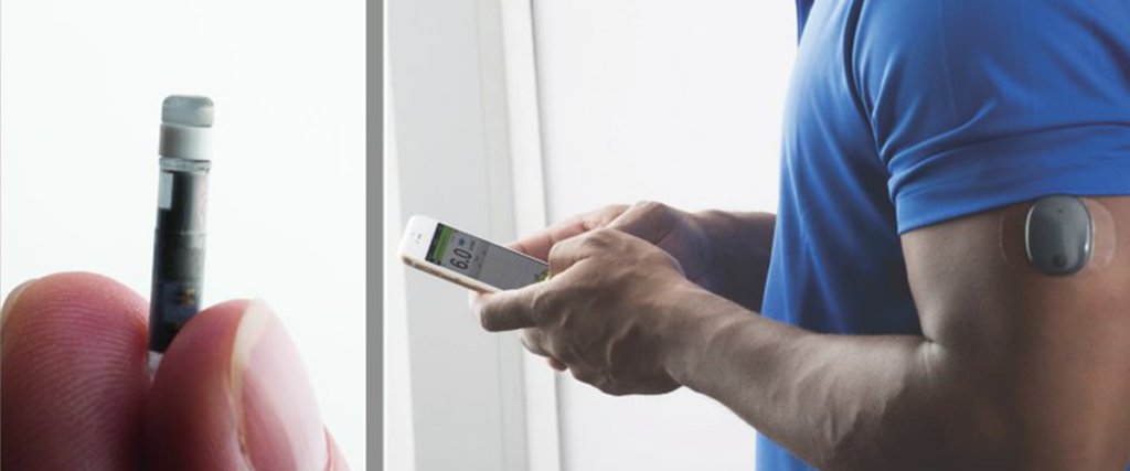 Eversense cgm system in use