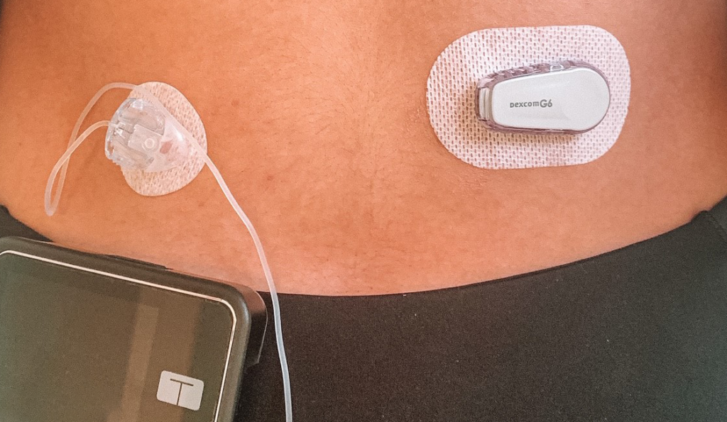t slim dexcom closed loop, tandem t slim x2 closed loop, t-slim x2 closed loop diy, t slim closed loop system