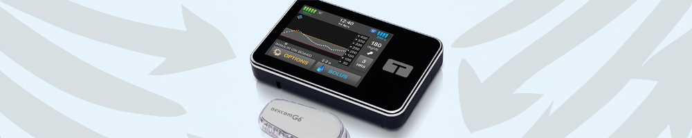 t slim dexcom closed loop, tandem t slim x2 closed loop, t-slim x2 closed loop diy, t slim closed loop system